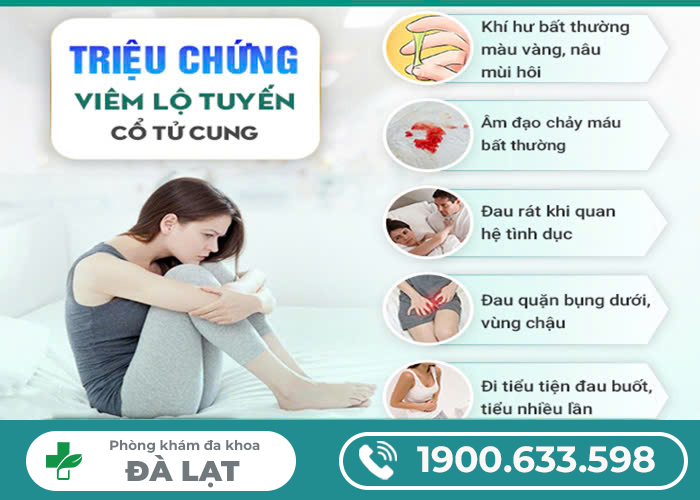 Hình ảnh minh họa